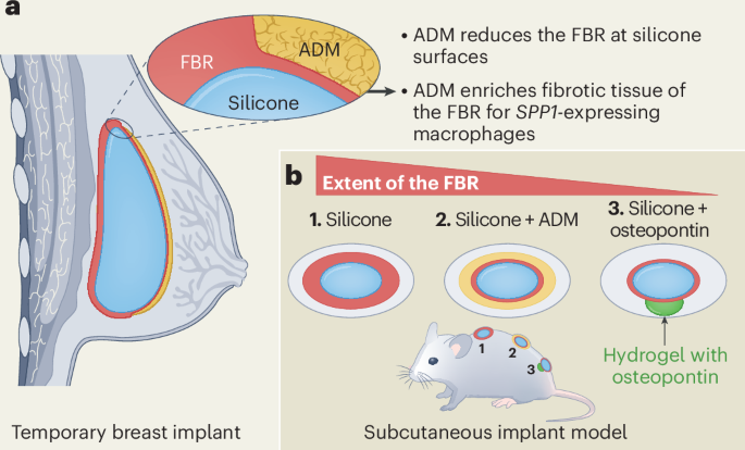 osteopontin-de-escalates-the-foreign-body-response