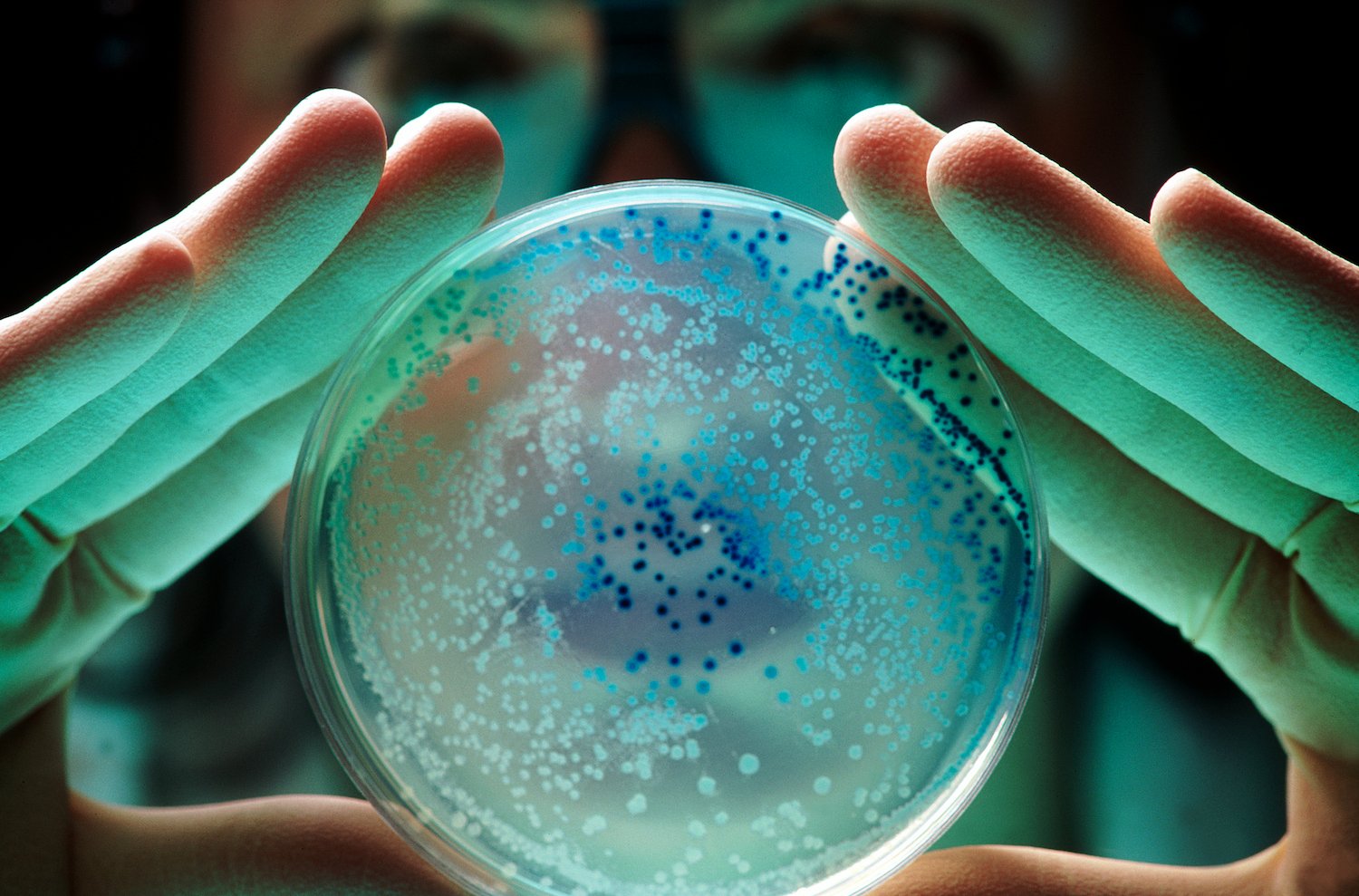 ai-designed-protein-disarms-membrane-transporter-to-defeat-resistant-bacteria