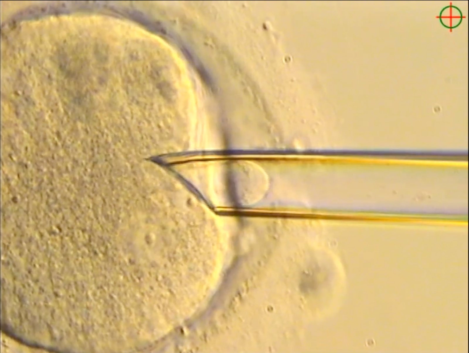mitochondrial-disease-milestone:-eight-babies-born-free-of-disease-via-pronuclear-transfer