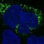 new-ai-tool-illuminates-‘dark-side’-of-the-human-genome