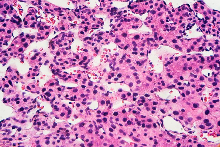 b-cell–driven-immunometabolic-strategy-halts-liver-tumors-in-mice