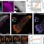molecular-imaging-tech-measures-forces-in-living-cells-with-nanometer-level-precision