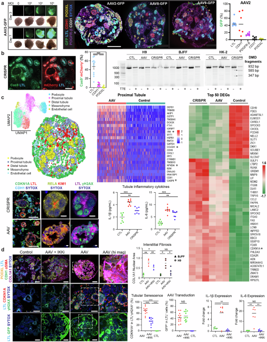 aav-for-gene-therapy-drives-a-nephrotoxic-response-via-nfκb-in-kidney-organoids