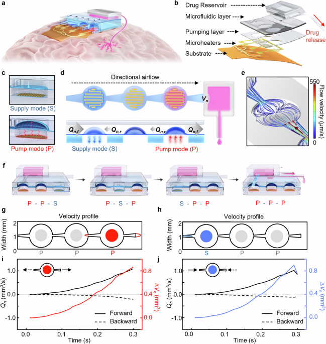 a-soft-neural-interface-with-a-tapered-peristaltic-micropump-for-wireless-drug-delivery