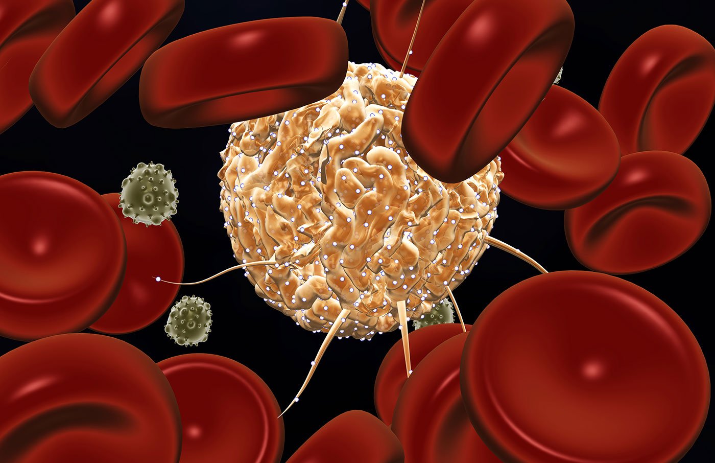 Ischemia Drives Breast Cancer Growth in Mice by Weakening Immunity