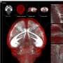 ionic-liquids-turn-whole-organs-transparent-like-glass-while-preserving-intricate-tissue-details