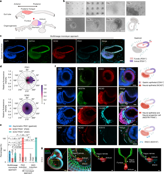 human-gastroids-to-model-regional-patterning-in-early-stomach-development