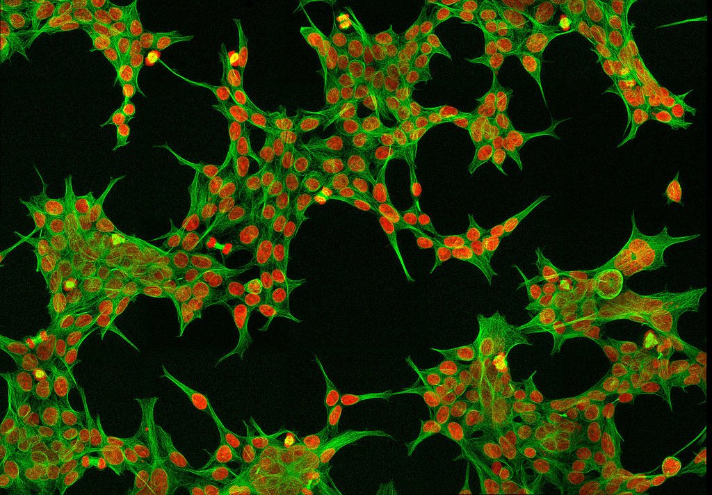 new-hek293-perfusion-a-medium-introduced-for-gene-therapy-production