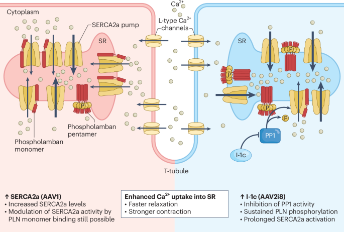 cardiac-gene-therapy-makes-a-comeback