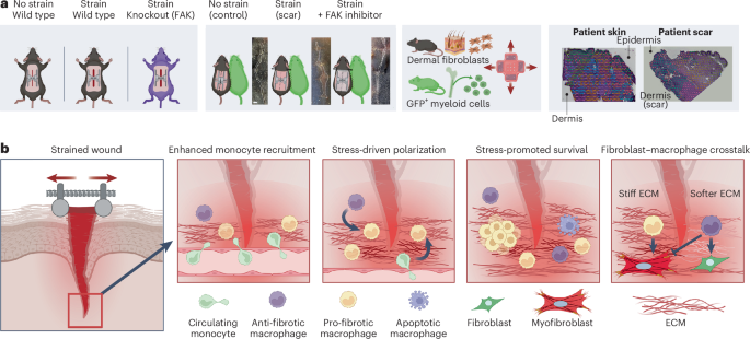 targeting-myeloid-cell-mediated-fibrosis-through-fak
