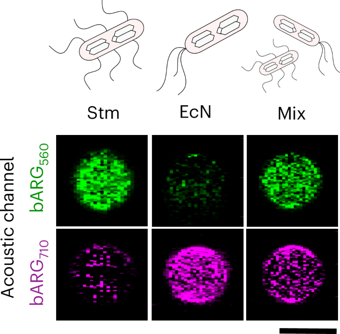engineered-acoustic-reporters-for-simultaneous-tracking-of-two-variables-on-ultrasonography