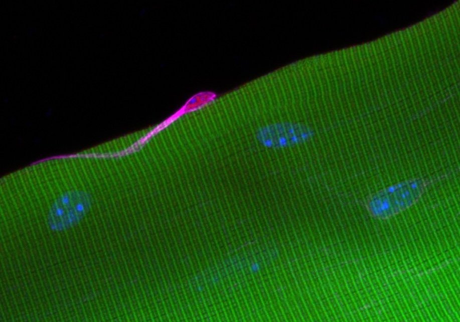 muscle-stem-cells-bolstered-by-ecm-protein-tenascin-c