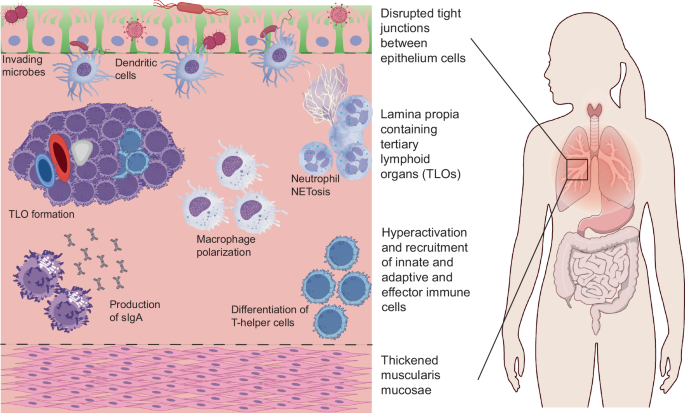 immunomodulatory-biomaterials-for-treating-chronic-inflammation-at-mucosal-sites