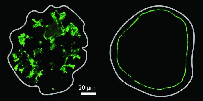 organoids-reveal-how-pressure-and-growth-shape-pancreatic-lumens