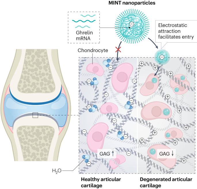 lesion-targeted,-severity-responsive-nanoparticle-delivery-for-rna-therapy-in-osteoarthritis