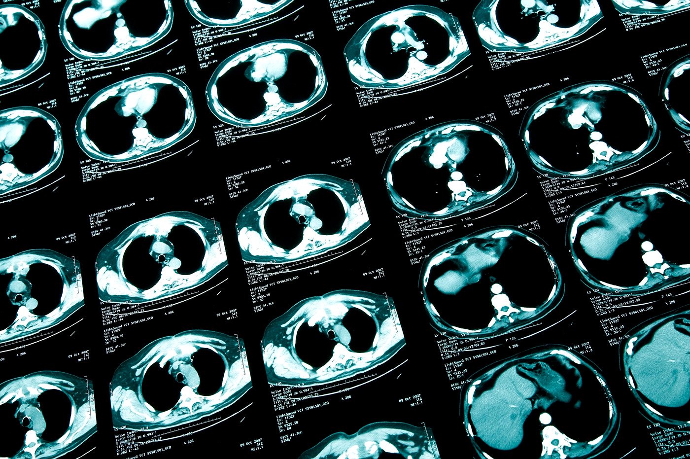 improving-biopharma-sponsor-access-to-clinical-trial-imaging-data