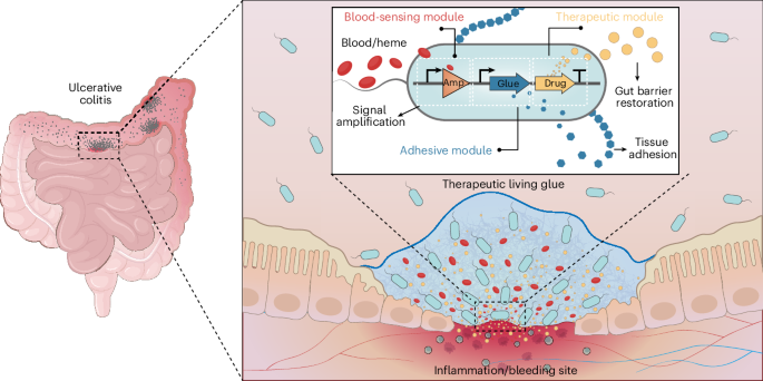 a-therapeutic-glue-that-autonomously-targets-gut-bleeding-in-inflammatory-bowel-disease