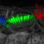 Unprecedented 3D views of sensory cells accelerate hearing research