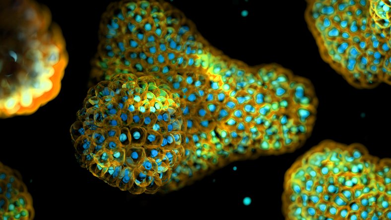 ixcells-and-rosebud-biosciences-partner-on-organoid-based-rare-disease-models