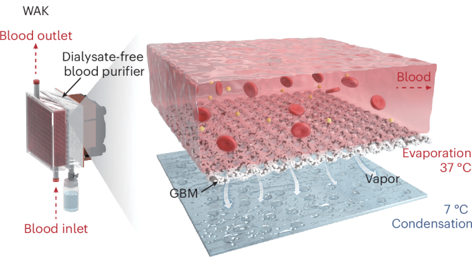a-dialysate-free-wearable-artificial-kidney-prototype-driven-by-a-liquid–gas-phase-transition