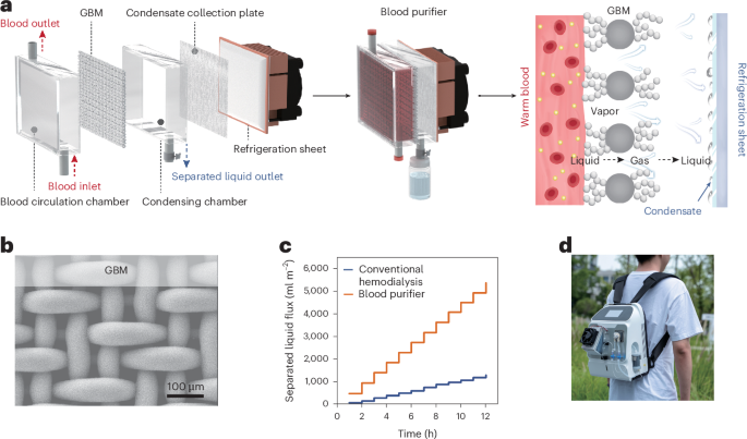 a-prototype-of-a-dialysate-fluid-free-wearable-artificial-kidney-for-dialysis-on-the-go