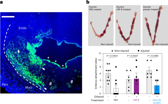 Endometrium-targeted mRNA-lipid nanoparticles for treating reproductive conditions