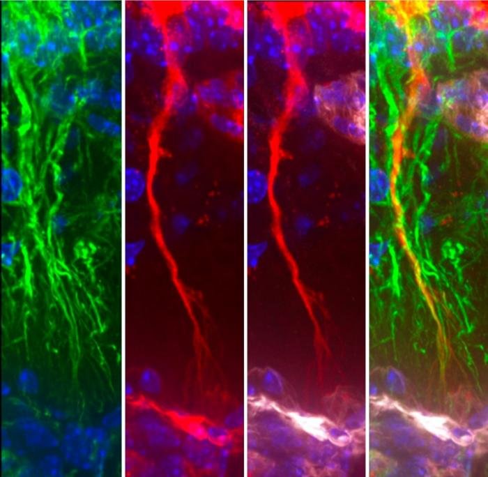 degenerating-tanycytes-disrupt-tau-removal,-shaping-alzheimer’s-progression
